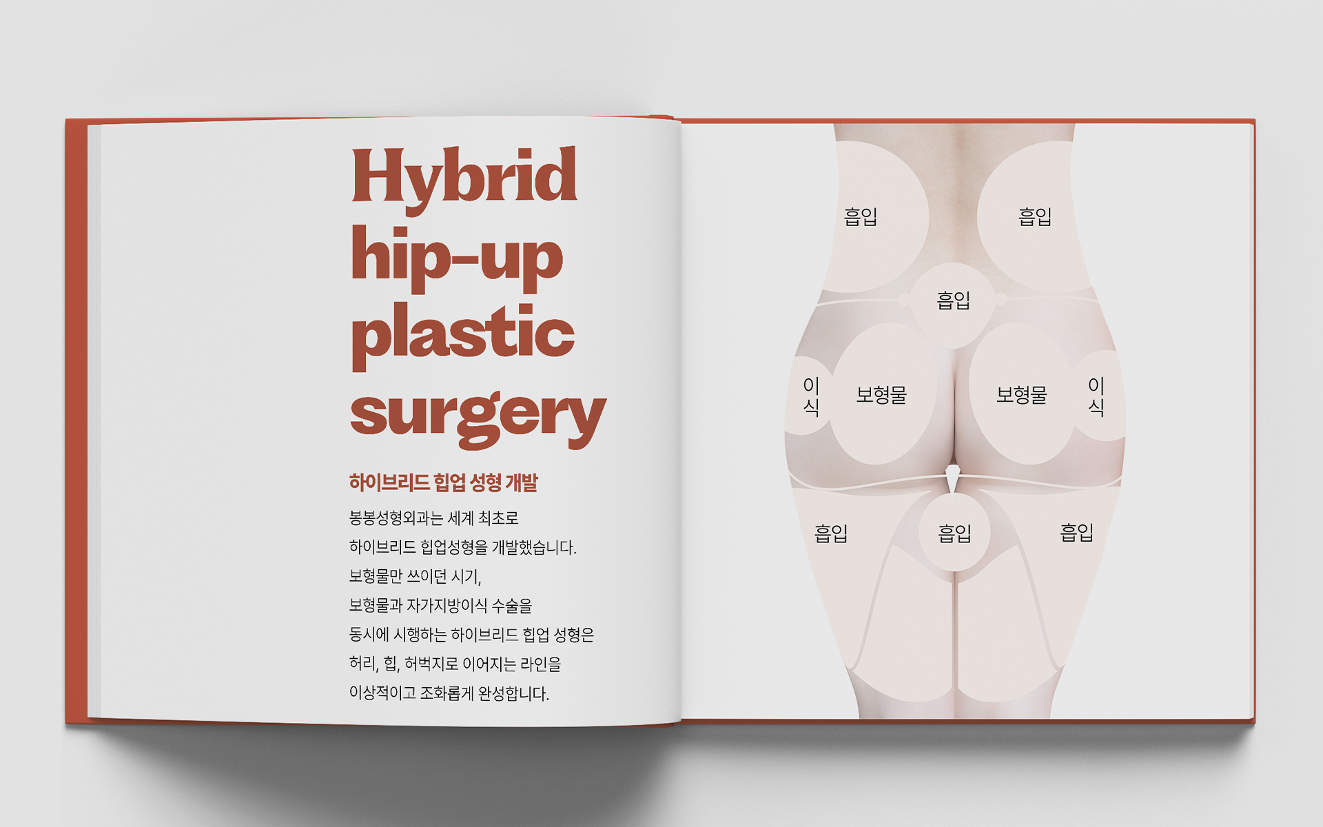 Butt Augmentation with Implants in Korea at BongBong Plastic Surgery in Seoul