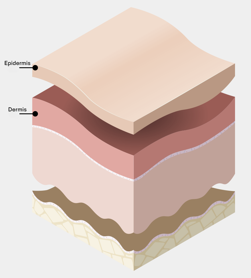 Scar and Stretch Mark Treatment in Korea at BongBong Plastic Surgery in Seoul