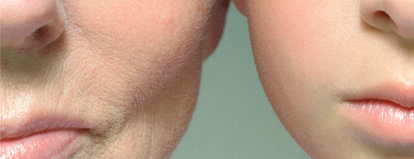 Anti-aging Treatment in Korea at BongBong Plastic Surgery in Seoul