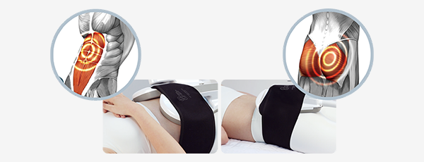 Anti-aging Treatment in Korea at BongBong Plastic Surgery in Seoul