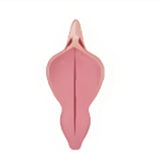 Labiaplasty in Korea at BongBong Plastic Surgery in Seoul